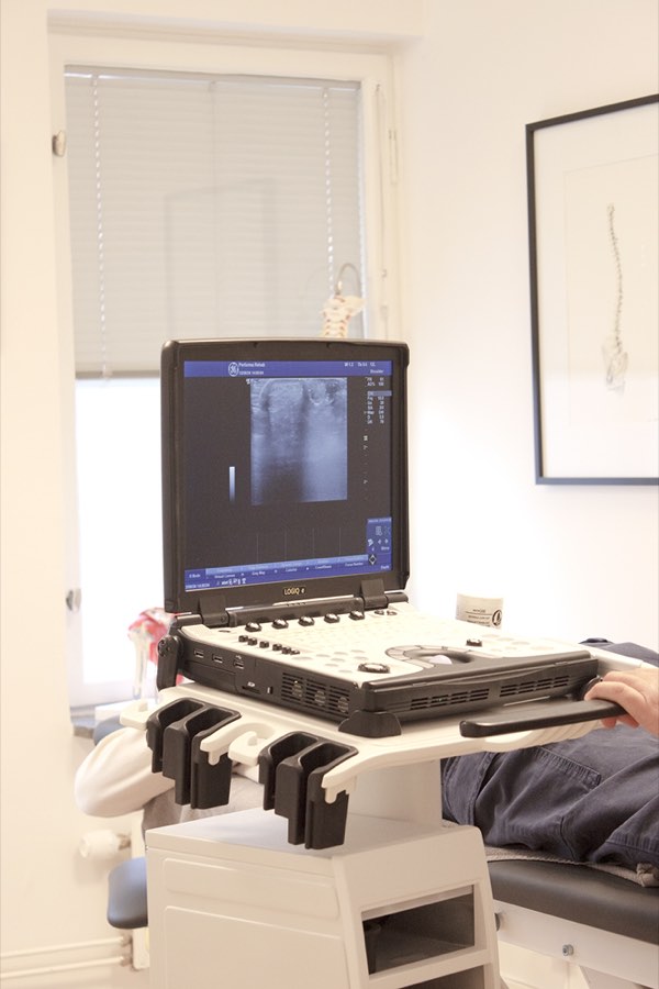 Ultraljudsapparaten hos Performa Rehab med bild på en axel